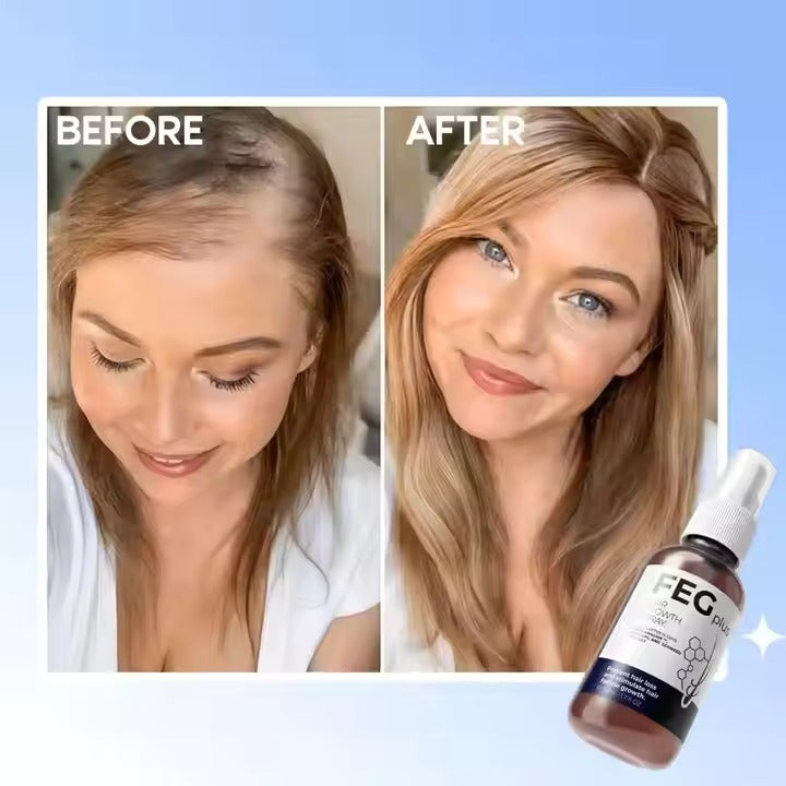 FEG Plus Hair Spray – بخاخ ينبت الشعر بسرعة ويريّحك من التساقط
